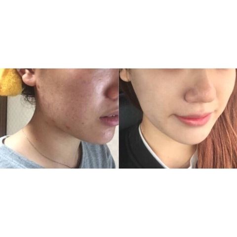 JuzBeauty_JuzBeautyMalaysia_JuzPretty_Authentic_Kbeauty_Malaysia_Jbeauty_Australia_Health_Care_CUBE_Skin_Trouble_Soap_Bar_ (2).jpeg