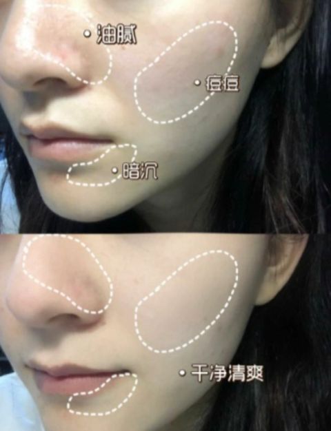 JuzBeauty_JuzBeautyMalaysia_JuzPretty_Authentic_Kbeauty_Malaysia_Jbeauty_Australia_Health_Care_Gik_Amazon_White_Mud_Pack_ (11).jpg