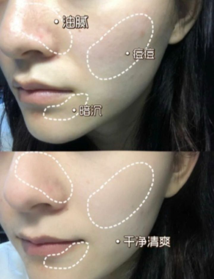 JuzBeauty_JuzBeautyMalaysia_JuzPretty_Authentic_Kbeauty_Malaysia_Jbeauty_Australia_Health_Care_Gik_Amazon_White_Mud_Pack_ (11).jpg