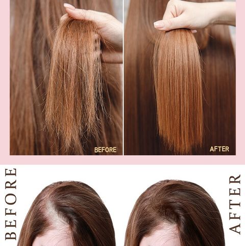 JuzBeauty_JuzBeautyMalaysia_JuzPretty_Authentic_Kbeauty_Malaysia_Jbeauty_Australia_Health_Care_MD1_Intensive_Peptide_Complex_Scalp_Ampoule_ (1).jpg