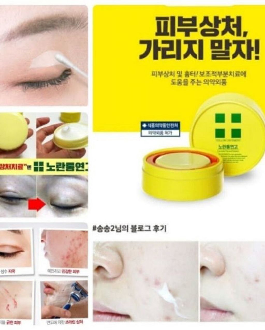 JuzBeauty_JuzBeautyMalaysia_JuzPretty_Authentic_Kbeauty_Malaysia_Jbeauty_Australia_Health_Care_Yellow_Ointment_Centella_Titrated_Extract_ (5).jpg