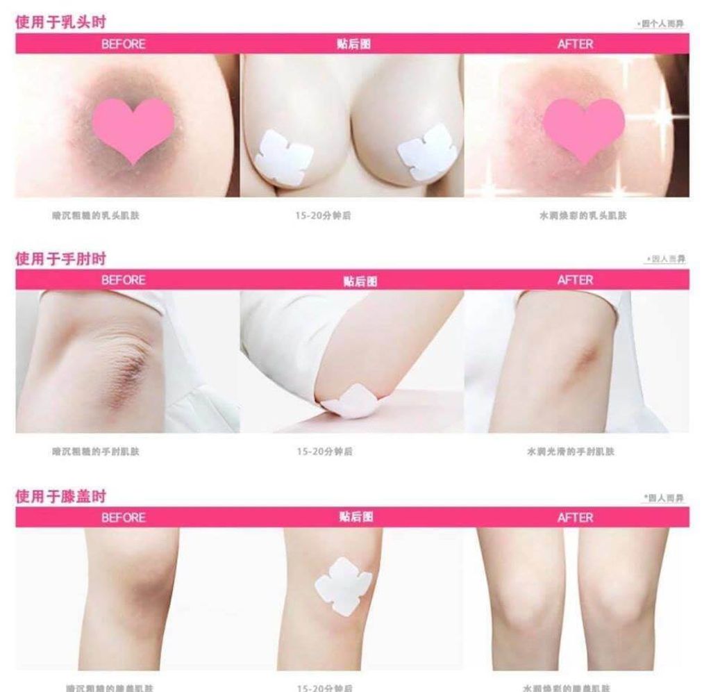 JuzBeauty_JuzBeautyMalaysia_JuzPretty_Authentic_Kbeauty_Malaysia_Jbeauty_Australia_Health_Care_The_ORCHID_Skin_Pink_Fantasy_Lady_Nipple_Patch_ (11).jpg