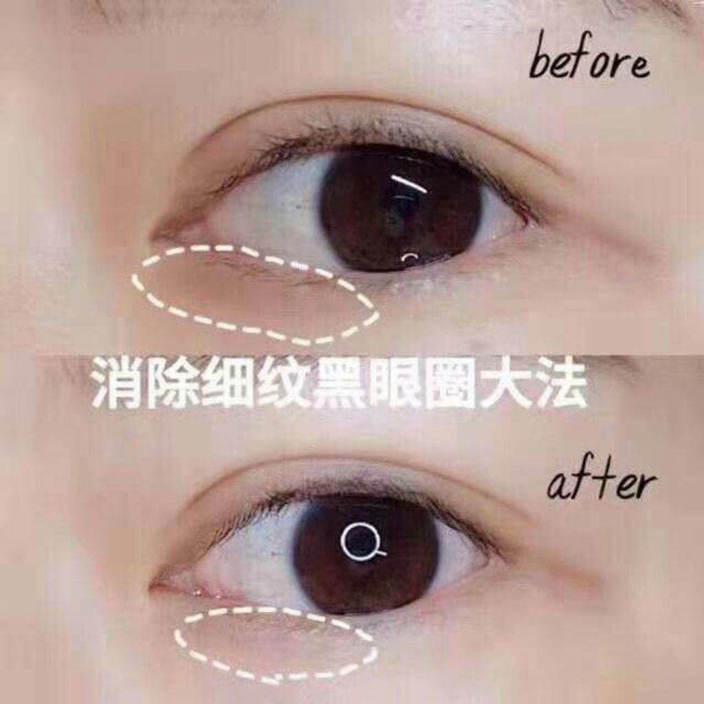 JuzBeauty_JuzBeautyMalaysia_JuzPretty_Authentic_Kbeauty_Malaysia_Jbeauty_Australia_Health_Care_The_ORCHID_Skin_Smoky_Under_Clear_Eye_Patch_The_ORCHID_Skin_Elastic_Under_Youth_Eye_Patch_ (2).jpg