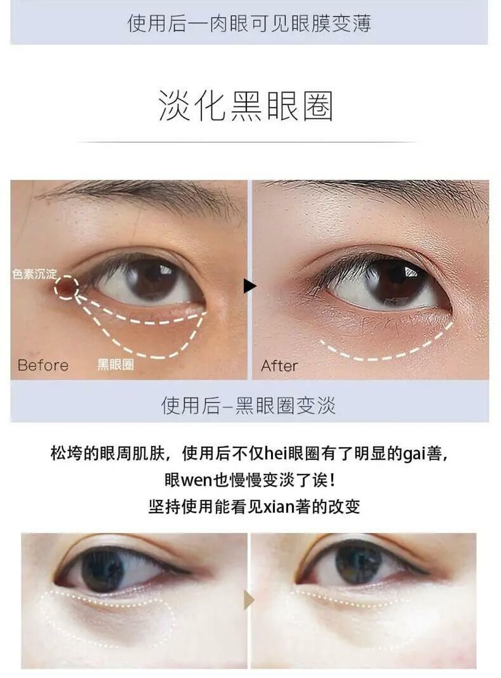 JuzBeauty_JuzBeautyMalaysia_JuzPretty_Authentic_Kbeauty_Malaysia_Jbeauty_Australia_Health_Care_The_ORCHID_Skin_Smoky_Under_Clear_Eye_Patch_The_ORCHID_Skin_Elastic_Under_Youth_Eye_Patch_ (19).jpg