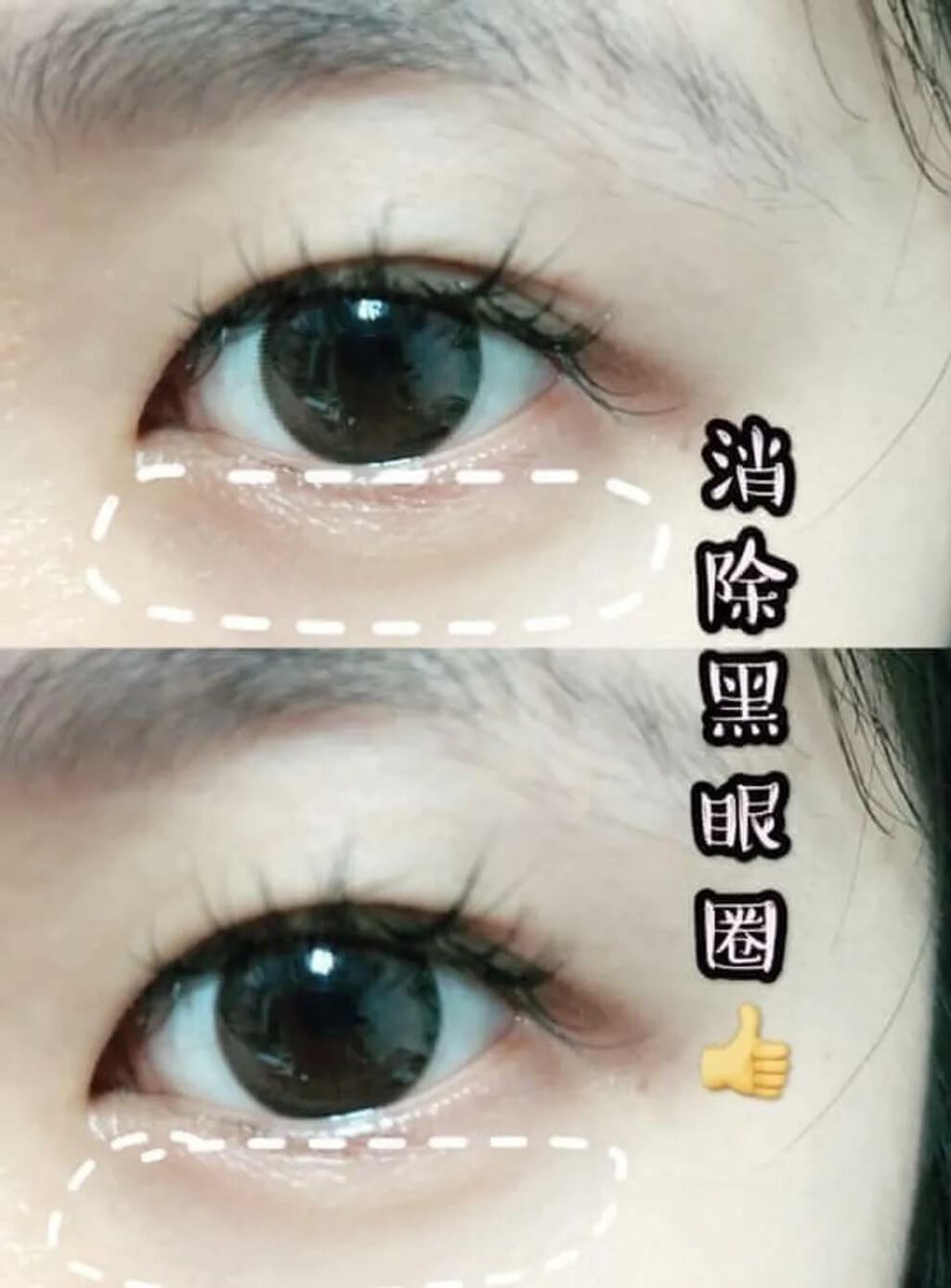 JuzBeauty_JuzBeautyMalaysia_JuzPretty_Authentic_Kbeauty_Malaysia_Jbeauty_Australia_Health_Care_The_ORCHID_Skin_Smoky_Under_Clear_Eye_Patch_The_ORCHID_Skin_Elastic_Under_Youth_Eye_Patch_ (20).jpg