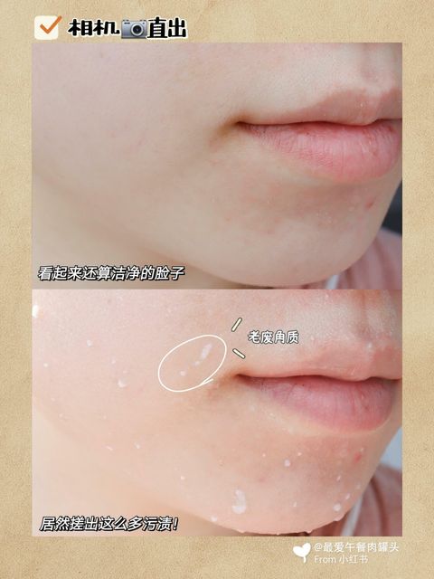 JuzBeauty_JuzBeautyMalaysia_JuzPretty_Authentic_Kbeauty_Malaysia_Jbeauty_Australia_Health_Care_Primera_Facial_Mild_Peeling_ (5).jpg