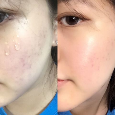 JuzBeauty_JuzBeautyMalaysia_JuzPretty_Authentic_Kbeauty_Malaysia_Jbeauty_Australia_Health_Care_CNP_Laboratory_Propolis_Energy_Ampule_ (16).jpg