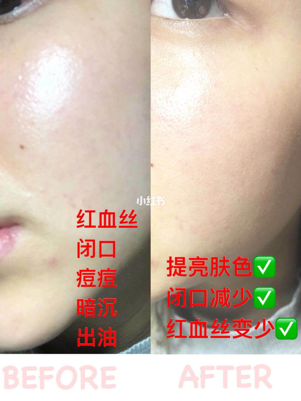 JuzBeauty_JuzBeautyMalaysia_JuzPretty_Authentic_Kbeauty_Malaysia_Jbeauty_Australia_Health_Care_CNP_Laboratory_Invisible_Peeling_Booster_ (15).jpg