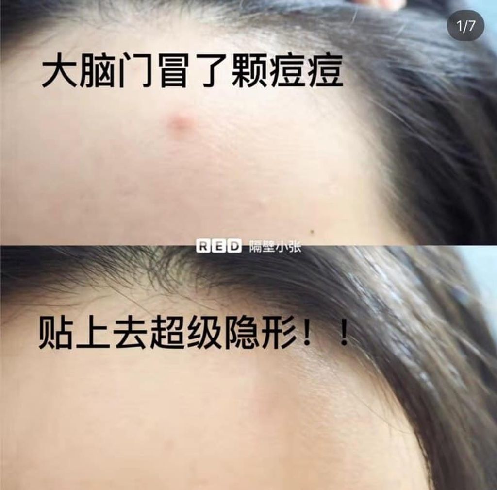 JuzBeauty_JuzBeautyMalaysia_JuzPretty_Authentic_Kbeauty_Malaysia_Jbeauty_Australia_Health_Care_Olive_Young_Care_Plus_Scar_Cover_Spot_Patch_Honey_ (14).jpg