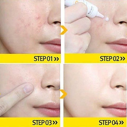 JuzBeauty_JuzBeautyMalaysia_JuzPretty_Authentic_Kbeauty_Malaysia_Skin_Care_Cosmetics_Jbeauty_Australia_Health_Care_Milky_Dress_Take_Care_Spot_ (7).jpg