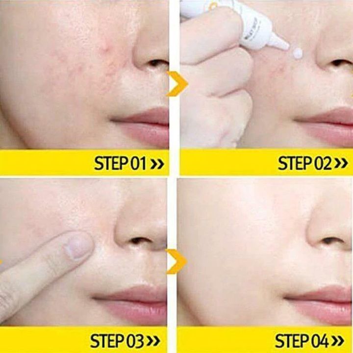 JuzBeauty_JuzBeautyMalaysia_JuzPretty_Authentic_Kbeauty_Malaysia_Skin_Care_Cosmetics_Jbeauty_Australia_Health_Care_Milky_Dress_Take_Care_Spot_ (7).jpg