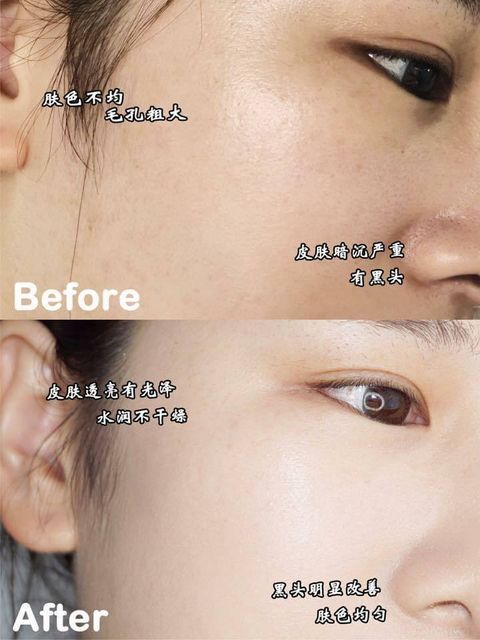 JuzBeauty_JuzBeautyMalaysia_JuzPretty_Authentic_Kbeauty_Malaysia_Skin_Care_Cosmetics_Jbeauty_Australia_Health_Care_Primera_Miracle_Seed_Essence_ (9).jpg