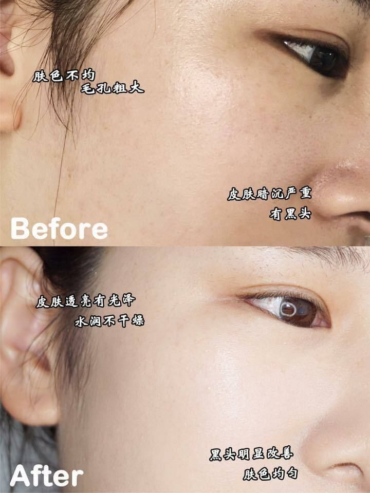 JuzBeauty_JuzBeautyMalaysia_JuzPretty_Authentic_Kbeauty_Malaysia_Skin_Care_Cosmetics_Jbeauty_Australia_Health_Care_Primera_Miracle_Seed_Essence_ (9).jpg