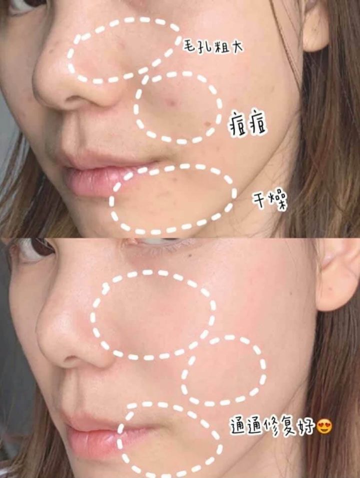 JuzBeauty_JuzBeautyMalaysia_JuzPretty_Authentic_Kbeauty_Malaysia_Skin_Care_Cosmetics_Jbeauty_Australia_Health_Care_EIIO_Hydration_Boosting_Toner_EIIO_Hydration_Boosting_Emulsion_ (14).jpg