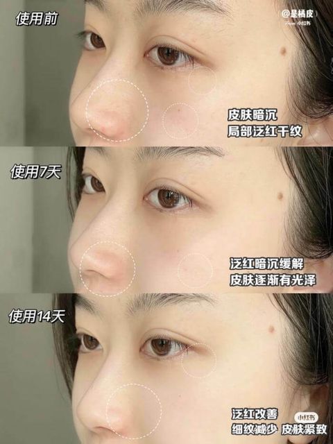 JuzBeauty_JuzBeautyMalaysia_JuzPretty_Authentic_Kbeauty_Malaysia_Skin_Care_Cosmetics_Jbeauty_Australia_Health_Care_Innisfree_Black_Tea_Youth_Enhancing_Ampoule_ (1).jpeg