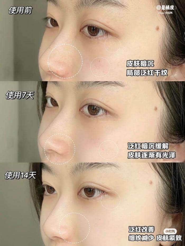JuzBeauty_JuzBeautyMalaysia_JuzPretty_Authentic_Kbeauty_Malaysia_Skin_Care_Cosmetics_Jbeauty_Australia_Health_Care_Innisfree_Black_Tea_Youth_Enhancing_Ampoule_ (1).jpeg