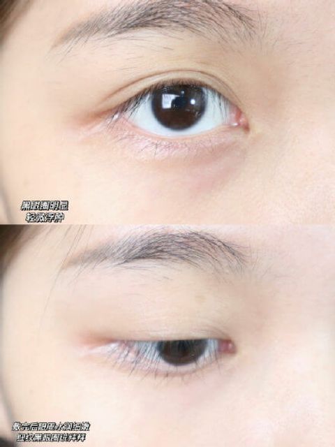 JuzBeauty_JuzBeautyMalaysia_JuzPretty_Authentic_Kbeauty_Malaysia_Skin_Care_Cosmetics_Jbeauty_Australia_Health_Care_Shangpree_Coral_Calming_Eye_Mask_ (6).jpg