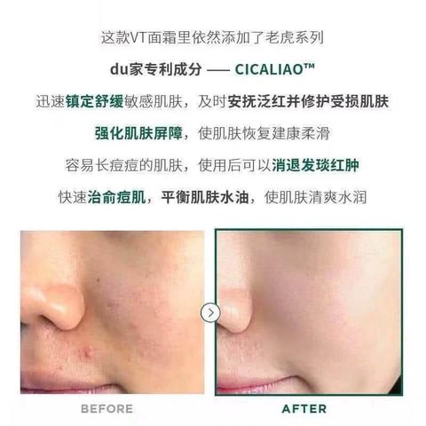JuzBeauty_JuzBeautyMalaysia_JuzPretty_Authentic_Kbeauty_Malaysia_Skin_Care_Cosmetics_Jbeauty_Australia_Health_Care_VT_Cosmetics_Cica_Cream_ (3).jpg