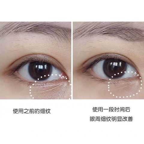 JuzBeauty_JuzBeautyMalaysia_JuzPretty_Authentic_Kbeauty_Malaysia_Skin_Care_Cosmetics_Jbeauty_Australia_Health_Care_SNP_Birds_Nest_Moisturizing_Eye_Patch_SNP_Gold_&_Collagen_Firming_Eye_Patch_SNP_Ruby_Nourishing_Eye_Patch_SNP_ ( (18).jpg