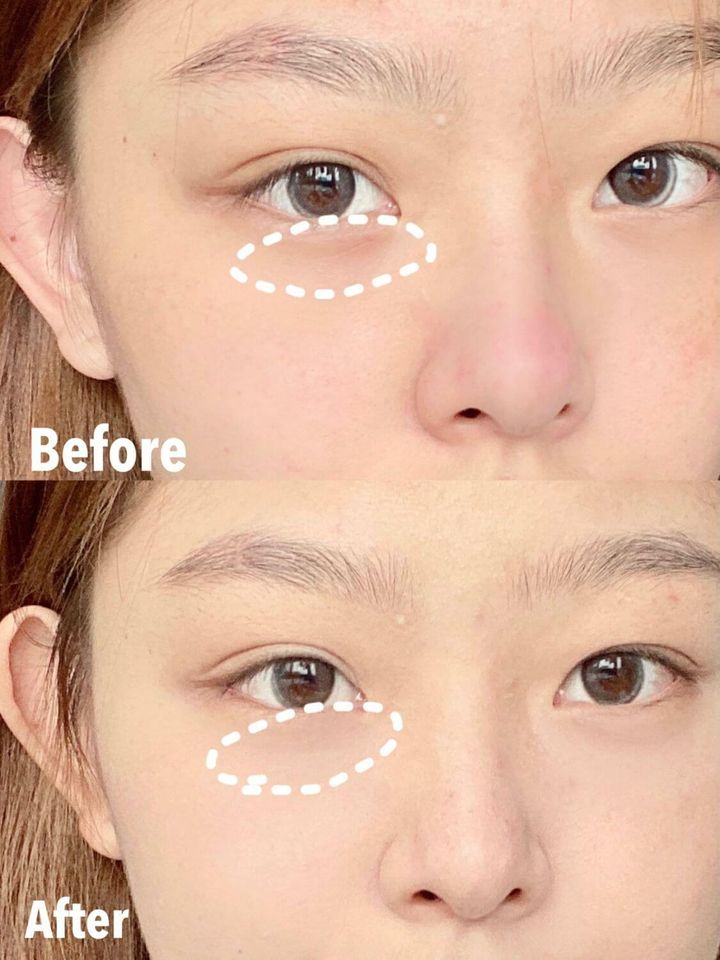 JuzBeauty_JuzBeautyMalaysia_JuzPretty_Authentic_Kbeauty_Malaysia_Skin_Care_Cosmetics_Jbeauty_Australia_Health_Care_Goodal_Green_Tangerine_Vita_C_Dark_Circle_Eye_Cream_ (11).jpg