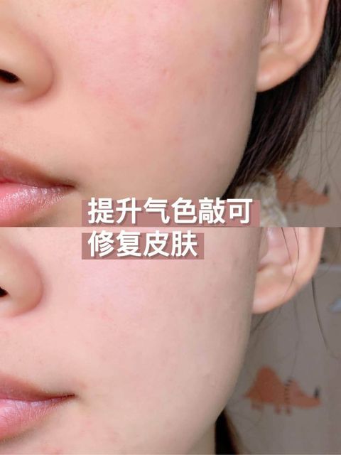 JuzBeauty_JuzBeautyMalaysia_JuzPretty_Authentic_Kbeauty_Malaysia_Skin_Care_Cosmetics_Jbeauty_Australia_Health_Care_SR21_Skin_Revitalise_Renew_Serum_ (5).jpg
