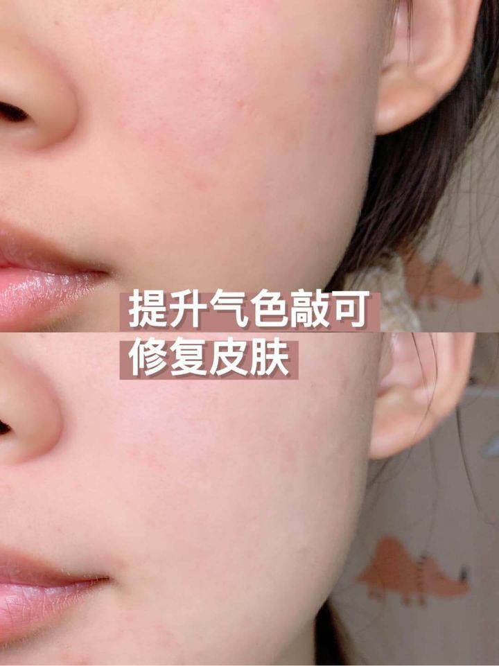 JuzBeauty_JuzBeautyMalaysia_JuzPretty_Authentic_Kbeauty_Malaysia_Skin_Care_Cosmetics_Jbeauty_Australia_Health_Care_SR21_Skin_Revitalise_Renew_Serum_ (5).jpg