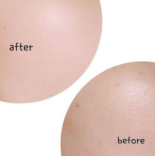 JuzBeauty_JuzBeautyMalaysia_JuzPretty_Authentic_Kbeauty_Malaysia_Skin_Care_Cosmetics_Jbeauty_Australia_Health_Care_VQM_Pluino_Spherical_Cream_ (9).jpg