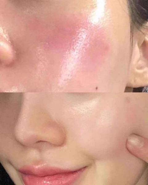 JuzBeauty_JuzBeautyMalaysia_JuzPretty_Authentic_Kbeauty_Malaysia_Skin_Care_Cosmetics_Jbeauty_Australia_Health_Care_VQM_Virexin_Premium_ (4).jpg