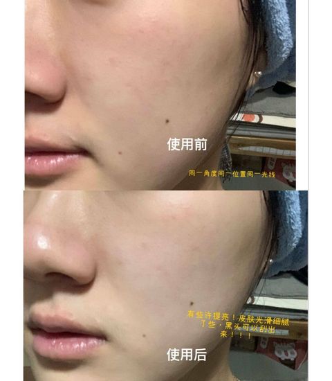 JuzBeauty_JuzBeautyMalaysia_JuzPretty_Authentic_Kbeauty_Malaysia_Skin_Care_Cosmetics_Jbeauty_Australia_Health_Care_AHC_Pro_Treatment_Creamy_Mud_Mask_ (8).jpg
