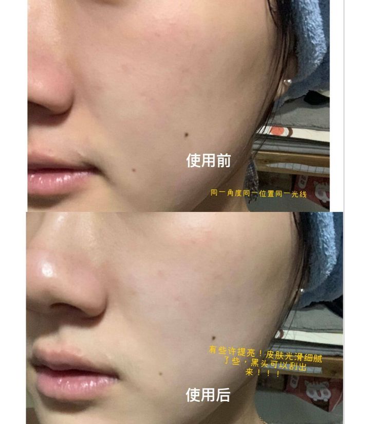 JuzBeauty_JuzBeautyMalaysia_JuzPretty_Authentic_Kbeauty_Malaysia_Skin_Care_Cosmetics_Jbeauty_Australia_Health_Care_AHC_Pro_Treatment_Creamy_Mud_Mask_ (8).jpg
