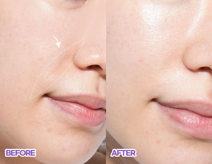 JuzBeauty_JuzBeautyMalaysia_JuzPretty_Authentic_Kbeauty_Malaysia_Skin_Care_Cosmetics_Jbeauty_Australia_Health_Care_Bioheal_Boh_Probioderm_Lifting_Collagen_Stick_.jpg