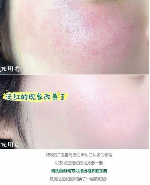 JuzBeauty_JuzBeautyMalaysia_JuzPretty_Authentic_Kbeauty_Malaysia_Skin_Care_Cosmetics_Jbeauty_Australia_Health_Care_VT_Cica_Capsule_Mask_ (2).jpg