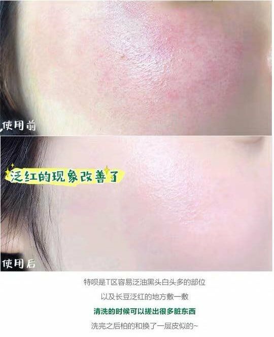 JuzBeauty_JuzBeautyMalaysia_JuzPretty_Authentic_Kbeauty_Malaysia_Skin_Care_Cosmetics_Jbeauty_Australia_Health_Care_VT_Cica_Capsule_Mask_ (2).jpg