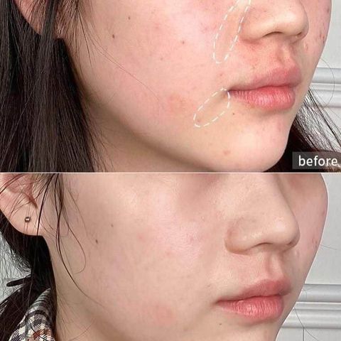 JuzBeauty_JuzBeautyMalaysia_JuzPretty_Authentic_Kbeauty_Malaysia_Skin_Care_Cosmetics_Jbeauty_Australia_Health_Care_VT_Progloss_Sheet_Mask_ (3).jpg