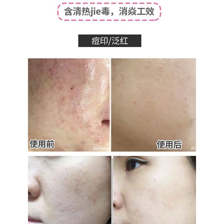 JuzBeauty_JuzBeautyMalaysia_JuzPretty_Authentic_Kbeauty_Malaysia_Skin_Care_Cosmetics_Jbeauty_Australia_Health_Care_VT_CICA_Sheet_Mask_ (7).jpg