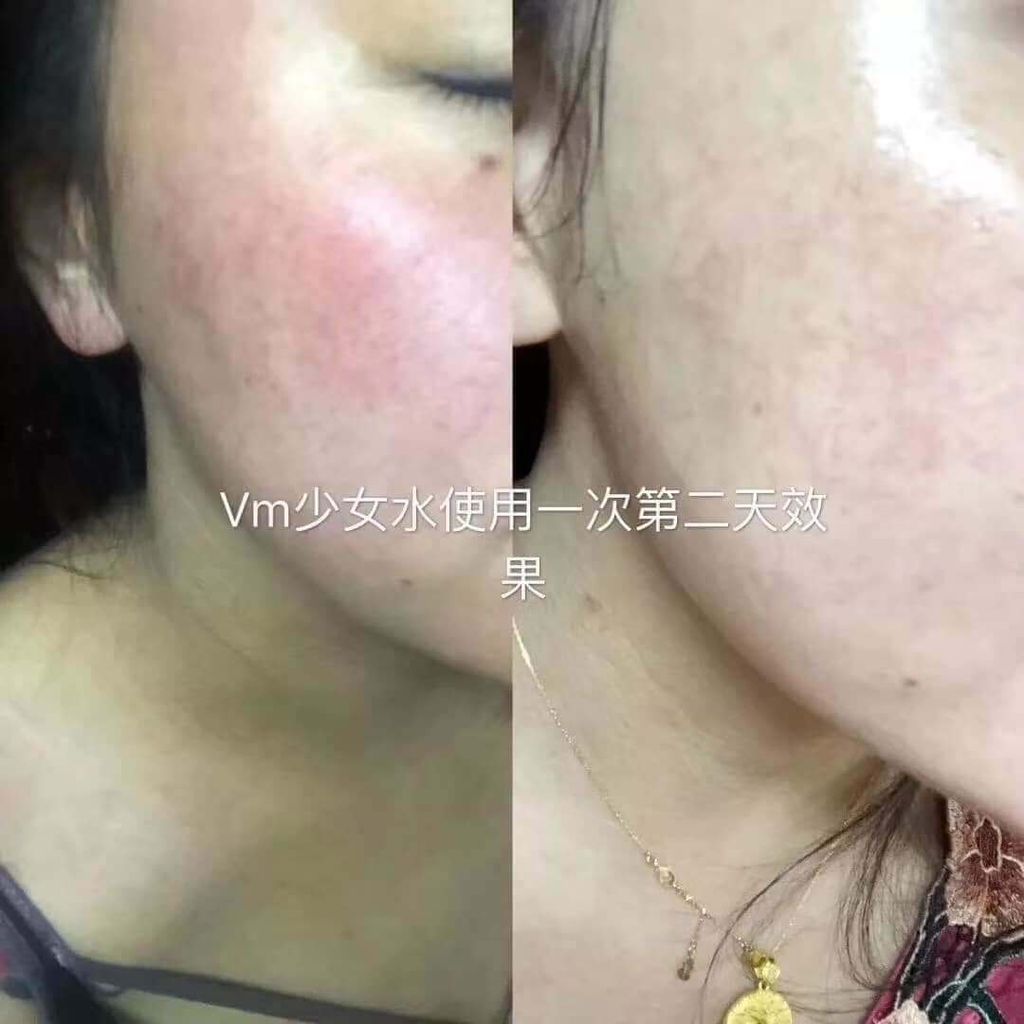 JuzBeauty_JuzBeautyMalaysia_JuzPretty_Authentic_Kbeauty_Malaysia_Skin_Care_Cosmetics_Jbeauty_Australia_Health_Care_Vanessa_Mattia_Gini_Bifida_Essence_Water_ (7).jpg