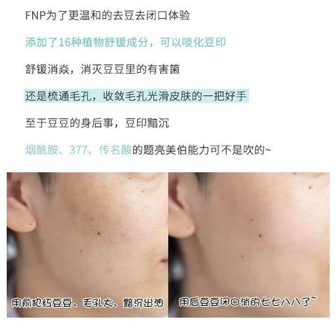 JuzBeauty_JuzBeautyMalaysia_JuzPretty_Authentic_Kbeauty_Malaysia_Skin_Care_Cosmetics_Jbeauty_Australia_Health_Care_FNP_Salicylic_Acid_Balance_Essence_Pads_ (7).jpg