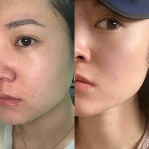 JuzBeauty_JuzBeautyMalaysia_JuzPretty_Authentic_Kbeauty_Malaysia_Skin_Care_Cosmetics_Jbeauty_Australia_Health_Care_Medicube_Red_Erasing_Cream_ (1).jpg