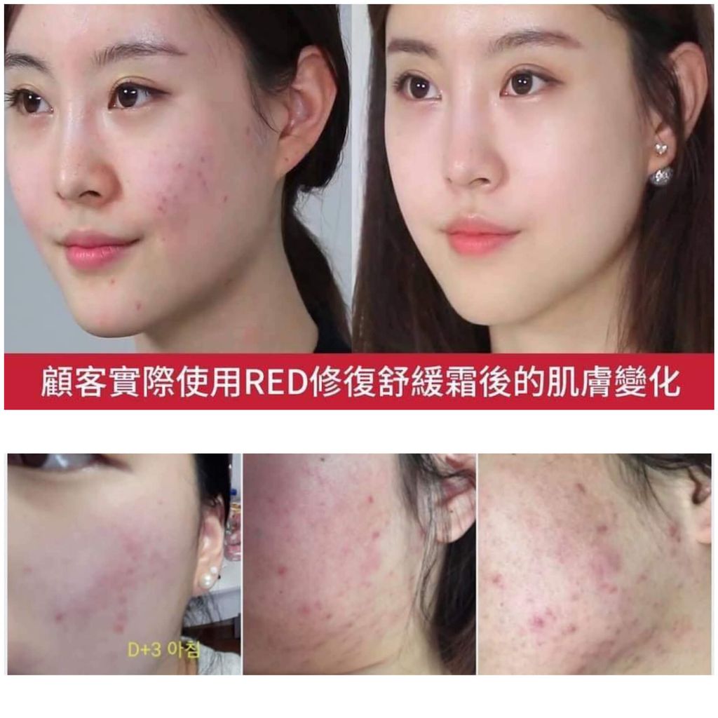 JuzBeauty_JuzBeautyMalaysia_JuzPretty_Authentic_Kbeauty_Malaysia_Skin_Care_Cosmetics_Jbeauty_Australia_Health_Care_Medicube_Red_Erasing_Cream_ (5).jpg