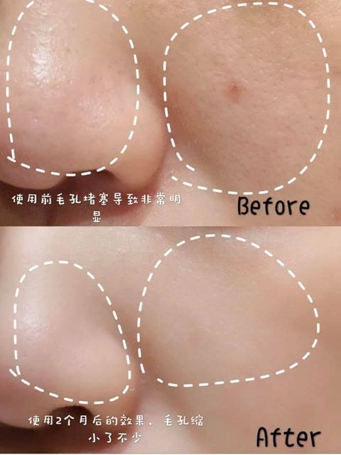 JuzBeauty_JuzBeautyMalaysia_JuzPretty_Authentic_Kbeauty_Malaysia_Skin_Care_Cosmetics_Jbeauty_Australia_Health_Care_Medicube_Zero_Pore_Pad_20_ (12).jpg