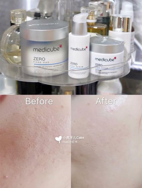 JuzBeauty_JuzBeautyMalaysia_JuzPretty_Authentic_Kbeauty_Malaysia_Skin_Care_Cosmetics_Jbeauty_Australia_Health_Care_Medicube_Zero_Pore_Cream_20_ (10).jpg