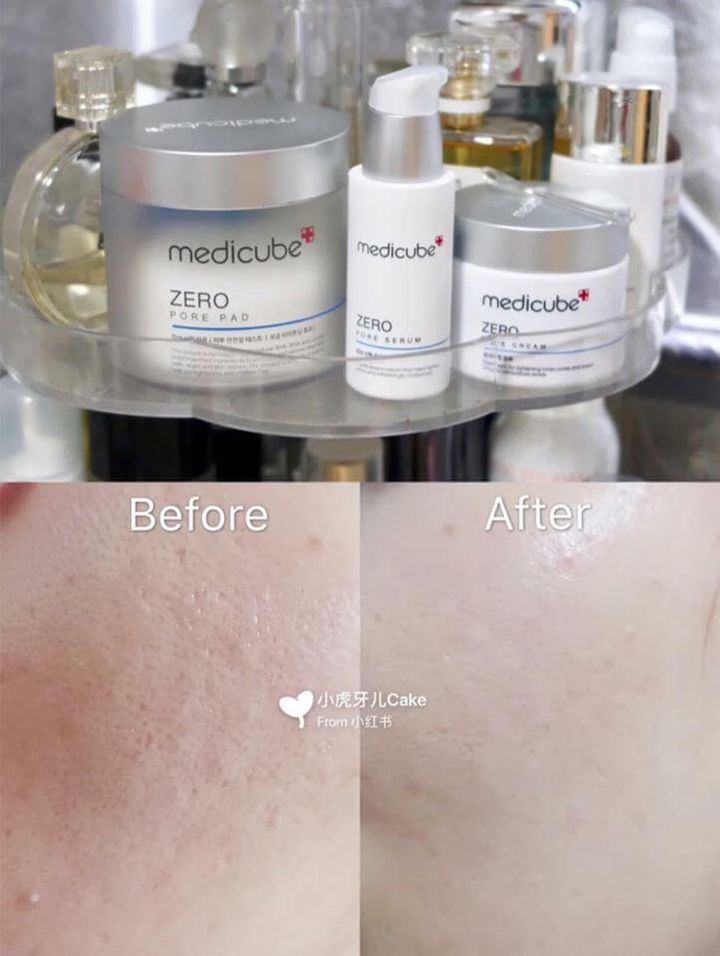 JuzBeauty_JuzBeautyMalaysia_JuzPretty_Authentic_Kbeauty_Malaysia_Skin_Care_Cosmetics_Jbeauty_Australia_Health_Care_Medicube_Zero_Pore_Cream_20_ (10).jpg