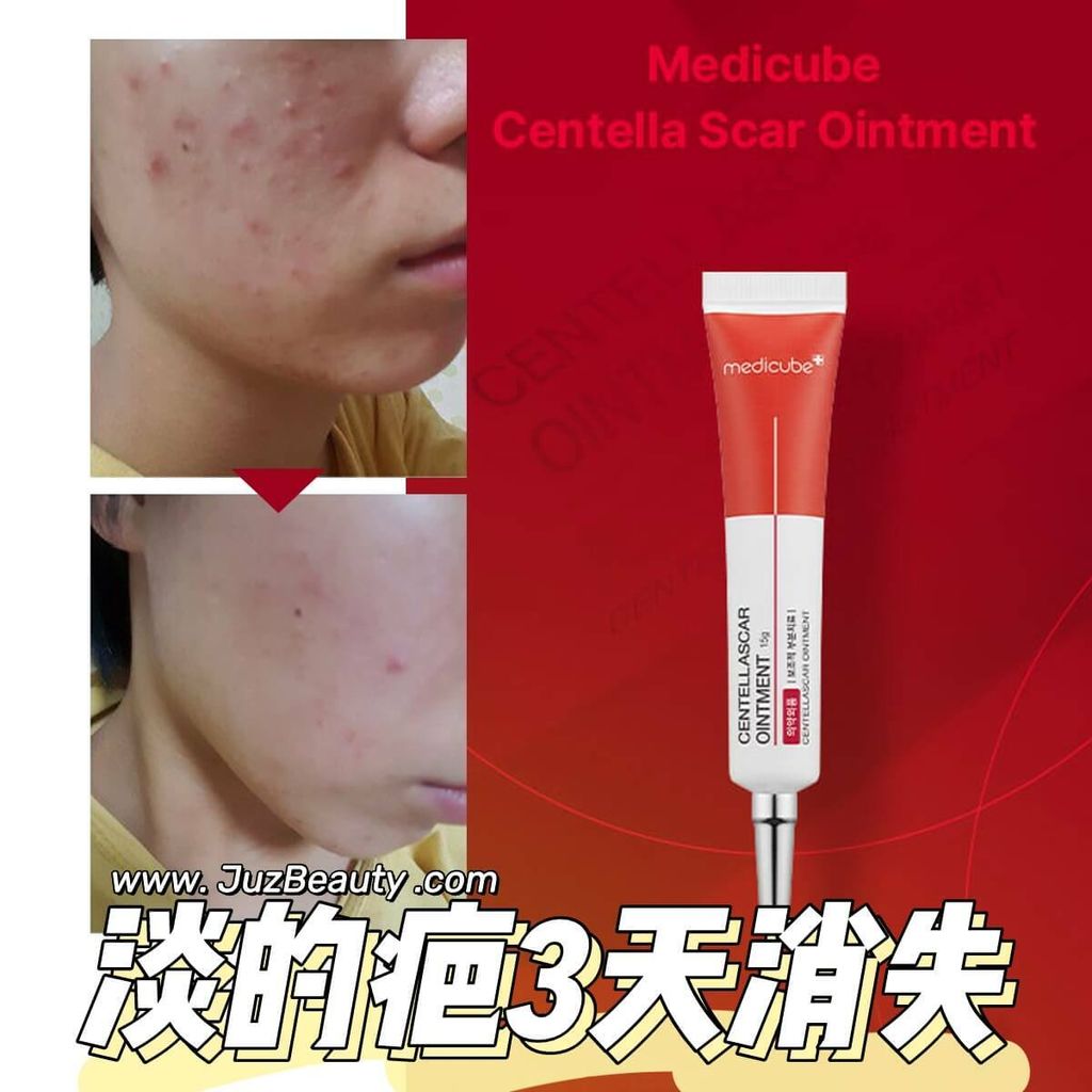 JuzBeauty_JuzBeautyMalaysia_JuzPretty_Authentic_Kbeauty_Malaysia_Skin_Care_Cosmetics_Jbeauty_Australia_Health_Care_Medicube_Centellascar_Ointment_ (5).jpg