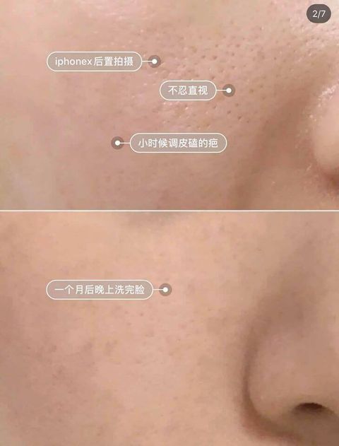 JuzBeauty_JuzBeautyMalaysia_JuzPretty_Authentic_Kbeauty_Malaysia_Skin_Care_Cosmetics_Jbeauty_Australia_Health_Care_Medicube_Zero_Pore_Serum_20_ (7).jpg