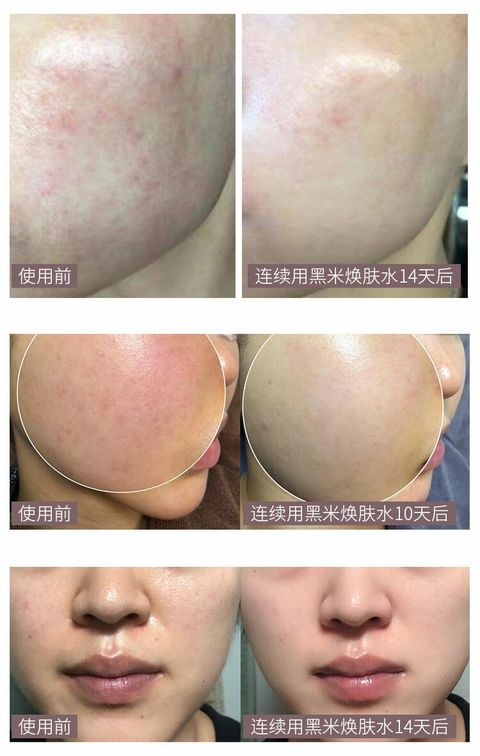 JuzBeauty_JuzBeautyMalaysia_JuzPretty_Authentic_Kbeauty_Malaysia_Skin_Care_Cosmetics_Jbeauty_Australia_Health_Care_haruharu_Wonder_Black_Rice_Hyaluronic_Toner_ (10).jpg