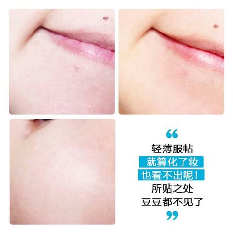 JuzBeauty_JuzBeautyMalaysia_JuzPretty_Authentic_Kbeauty_Malaysia_Skin_Care_Cosmetics_Jbeauty_Australia_Health_Care_Hatherine_Spot_Care_Patch_Kit_ (1).jpg