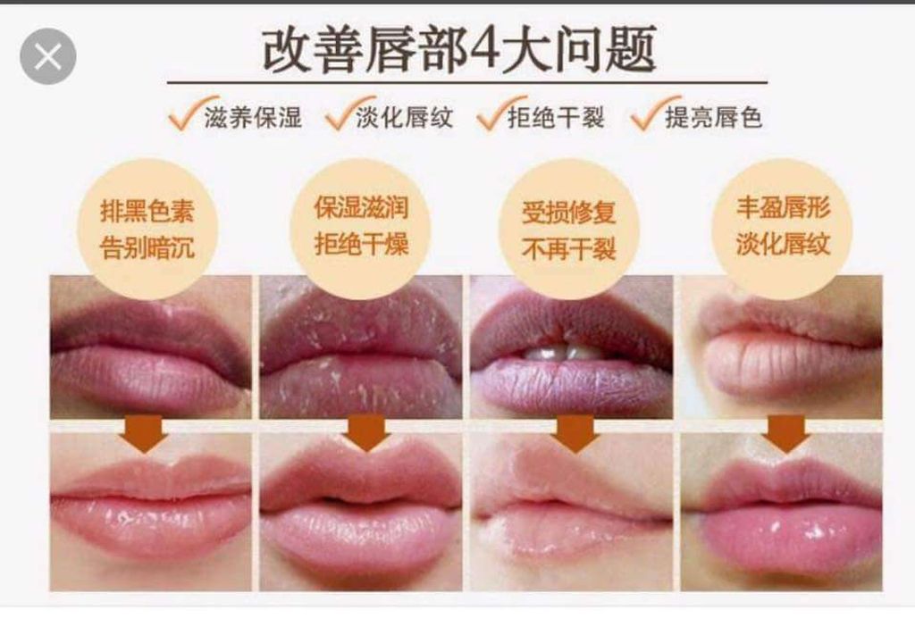 JuzBeauty_JuzBeautyMalaysia_JuzPretty_Authentic_Kbeauty_Malaysia_Skin_Care_Cosmetics_Jbeauty_Australia_Health_Care_Shiseido_Moilip_Medicated_Vitamin_E_B6_Lip_Cream_ (2).jpg