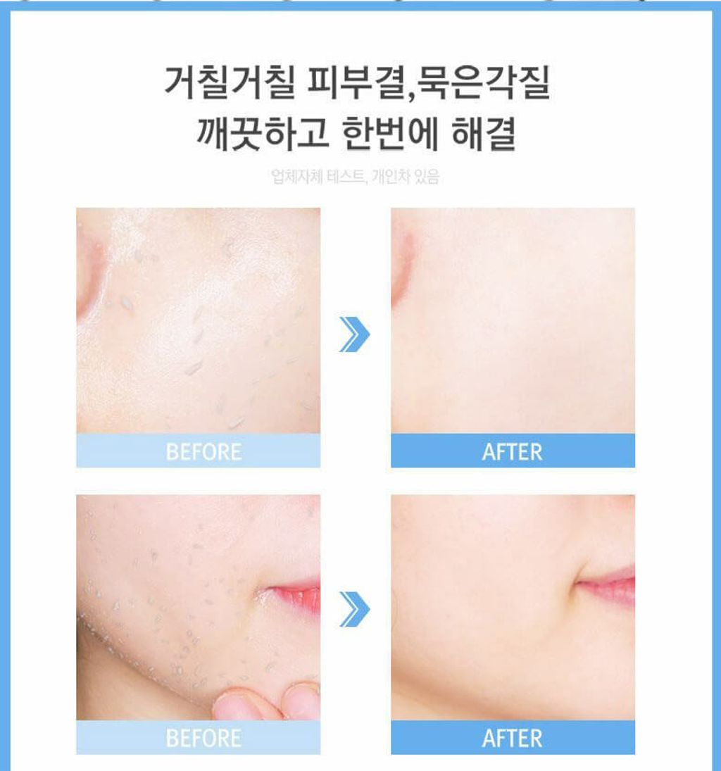 JuzBeauty_JuzBeautyMalaysia_JuzPretty_Authentic_Kbeauty_Malaysia_Skin_Care_Cosmetics_Jbeauty_Australia_Health_Care_RiRe_ALL_KILL_Refresh_Peeling_Gel_ (4).jpg