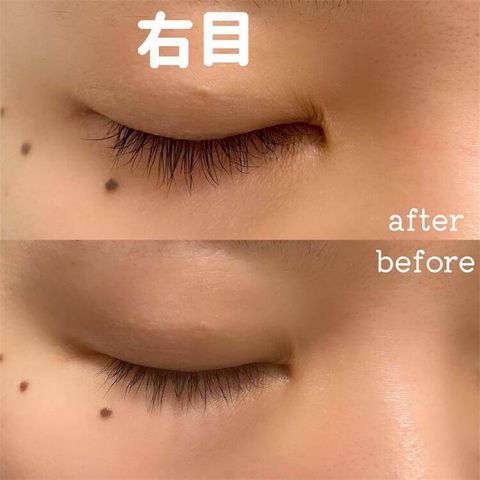 JuzBeauty_JuzBeautyMalaysia_JuzPretty_Authentic_Kbeauty_Malaysia_Skin_Care_Cosmetics_Jbeauty_Australia_Health_Care_UZU_By_Flowfushi_Eyelash_Serum_ (1).jpg