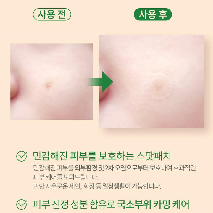 JuzBeauty_JuzBeautyMalaysia_JuzPretty_Authentic_Kbeauty_Malaysia_Skin_Care_Cosmetics_Jbeauty_Australia_Health_Care_Prreti_Easycare_Clean_Spot_Patch_ (2).jpg